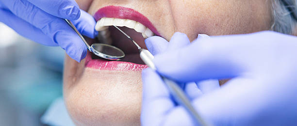 Best Emergency Broken Tooth Repair in Gantt, SC